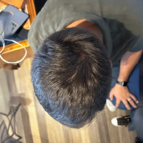 Después del tratamiento