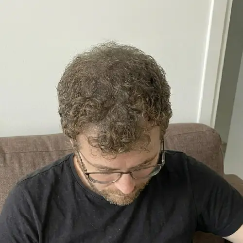 Después del tratamiento